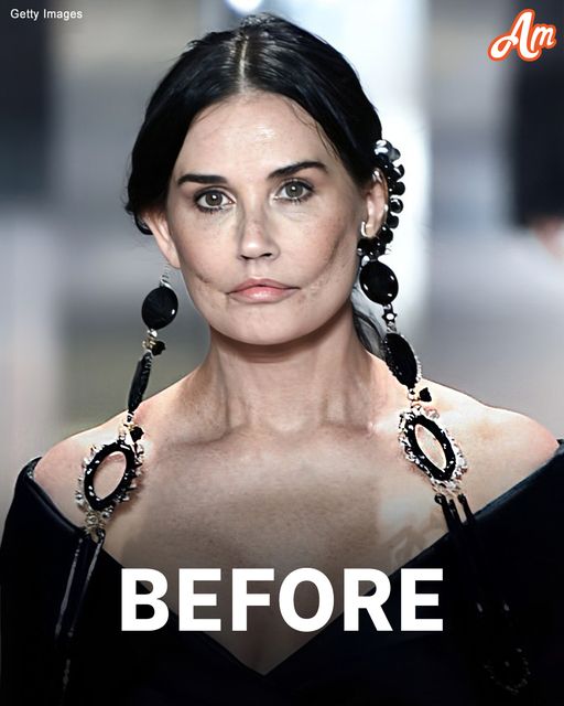 Demi Moore, 61, Appears to Be ‘Aging Backwards’ in Recent Pics – Aesthetics Doctor Weighs In