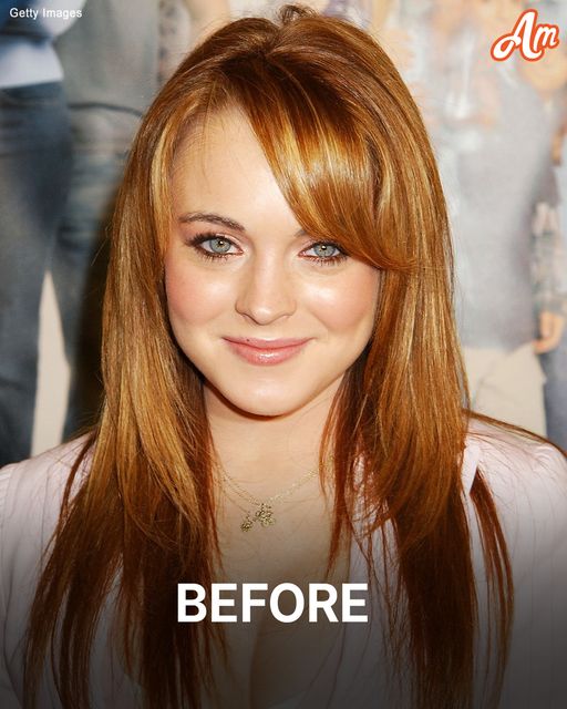 ‘What Has She Done to Her Face?’: Users Can’t ‘Recognize’ This ’00s Teen Idol After Long Battle with Addiction — Pics