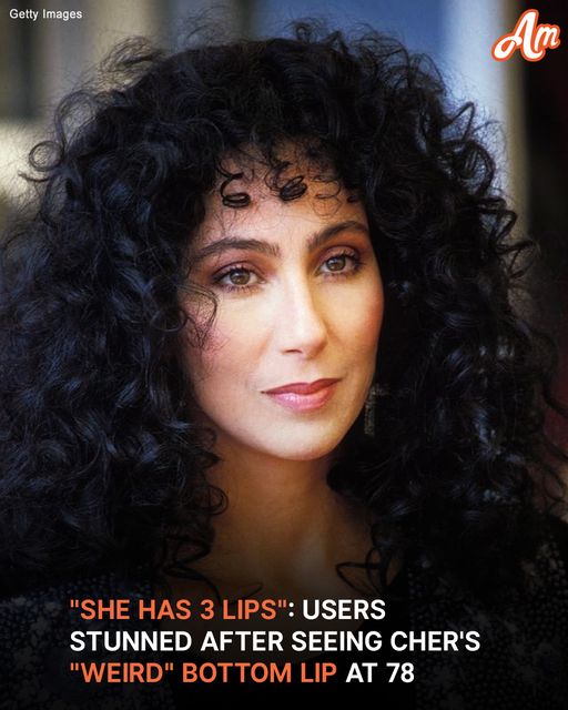 ‘What Happened to Her Lower Lip?’: Users Stunned After Seeing 78-Year-Old Cher on the ‘Today Show’ – Photos & Videos