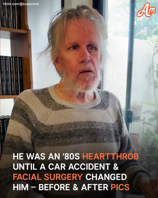 He Was A Hollywood Star In The ’80s, But Then Survived A Terrible Road Accident & Underwent Facial Surgery – His Pics At 80