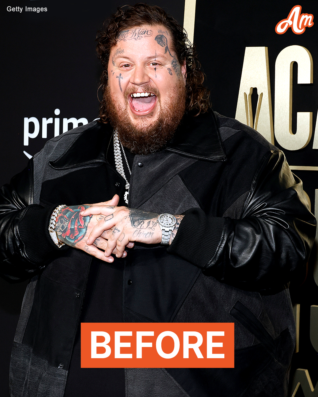 Jelly Roll Stuns with His ‘Phenomenal’ 100-Pound Weight Loss at the 2024 CMA Awards – Photos & Video